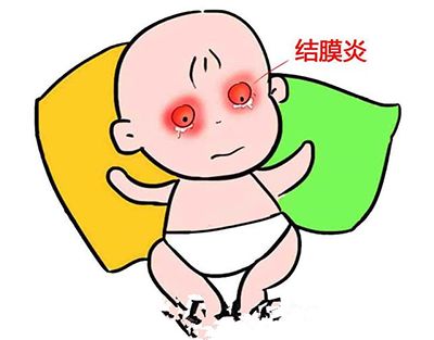 新生寶寶也會得結(jié)膜炎？ 新生兒結(jié)膜炎如何應對？